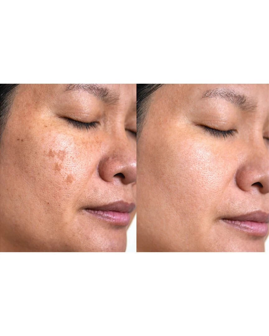 Predire Paris Collagen & Stem Cell Skin Transformation Routine Women Skincare Sets Predire Paris Collagen & Stem Cell Skin Transformation Routine Women Skincare Sets -PREDIRE PARIS Sales 1111151313 RLLZ 2