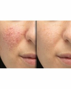 Predire Paris Anti-Aging Multi-Treatment Serum Collection Women Skincare Sets -PREDIRE PARIS Sales 1111182716 RLLZ 9