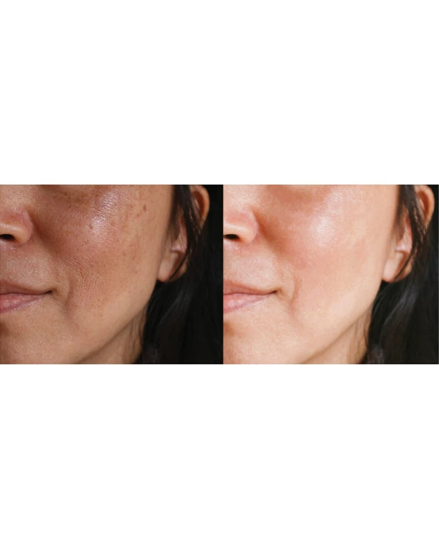 Predire Paris Skin Rejuvenation Device Women Tools & Styling Predire Paris Skin Rejuvenation Device Women Tools & Styling -PREDIRE PARIS Sales 1111939339 RLLZ 2